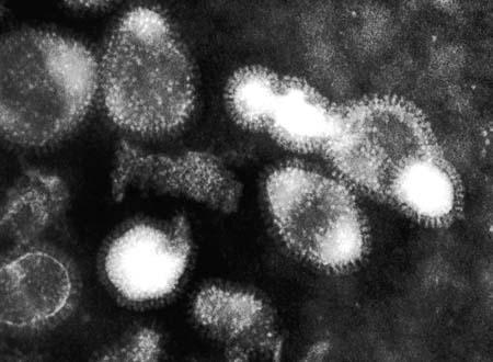 Nouvelles mutations du virus H5N1 découvertes.