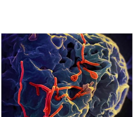 EBOLA : Ces protéines amyloïdes du sperme qui favorisent la transmission virale