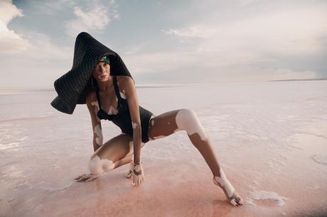 Winnie Harlow par Emre Guven Winnie Harlow par Emre Guven