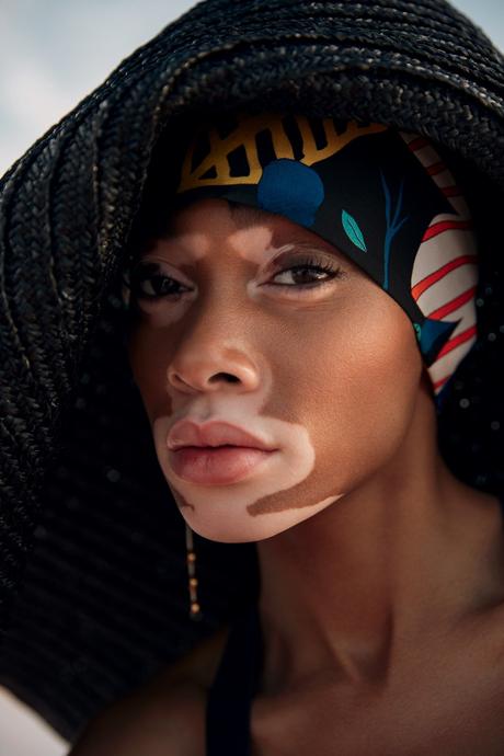 Winnie Harlow par Emre Guven Winnie Harlow par Emre Guven