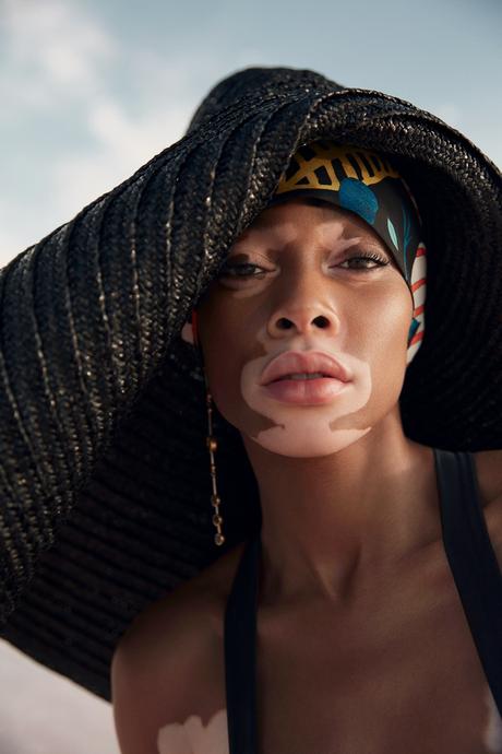 Winnie Harlow par Emre Guven Winnie Harlow par Emre Guven