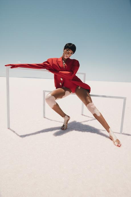 Winnie Harlow par Emre Guven Winnie Harlow par Emre Guven
