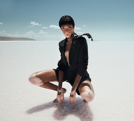 Winnie Harlow par Emre Guven Winnie Harlow par Emre Guven