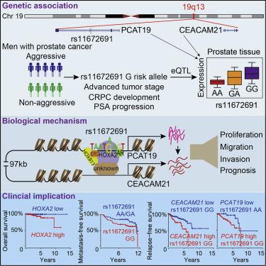 #cell #cancerdelaprostate #19q13 Biologie et Implications Cliniques du Locus de Susceptibilité au Cancer de la Prostate Agressif 19q13 #cell #cancerdelaprostate #19q13 Biologie et Implications Cliniques du Locus de Susceptibilité au Cancer de la Prostate Agressif 19q13