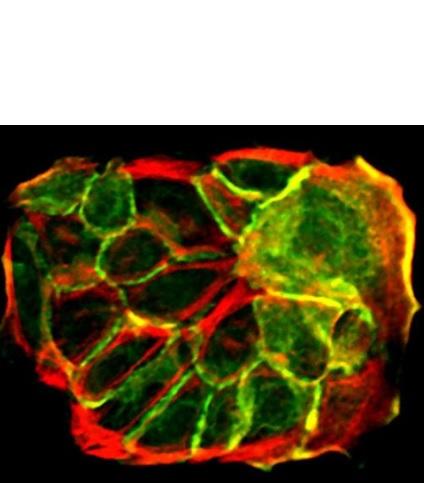 SANTÉ CUTANÉE et CICATRISATION : Les cellules souches s’organisent en fonction de la densité cellulaire