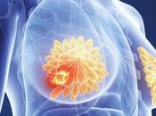 CANCER SEIN fruits, source naturelle d'antioxydants anticancéreux