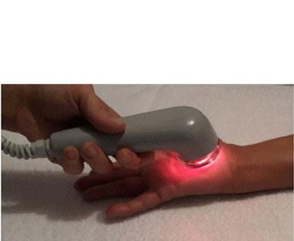 FIBROMYALGIE : Ultrasons et lumière laser sur les paumes contre la douleur
