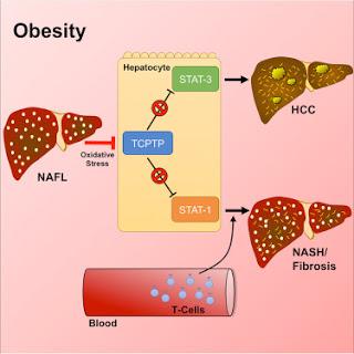 #Cell #obésité #stéatohépatitenonalcoolique #cancer L’Obésité Entraîne de Développement de la Stéatohépatite Non - Alcoolique (NASH) STAT-1 dépendante et du CHC STAT-3 dépendant