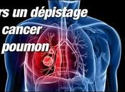 Cancer poumon vaste étude contredit l’intérêt d’un dépistage systématique