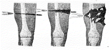 Il y a 150 ans, la déclaration de Saint Petersbourg : premier texte de droit interdisant une arme…