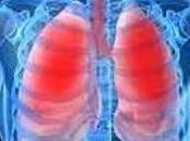 L’OBÉSITÉ associée maladie pulmonaire chronique chez non-fumeurs