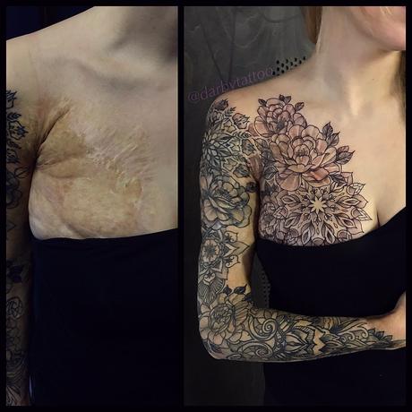 Ces tatoueurs embellissent les cicatrices