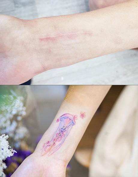 Ces tatoueurs embellissent les cicatrices