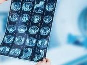 CANCER CERVEAU Bloquer propagation flux liquide interstitiel