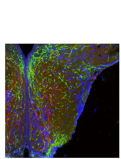  De longues projections filaires de neurones dans l'hypothalamus forment des circuits de poids corporel (en rouge et en vert ). 