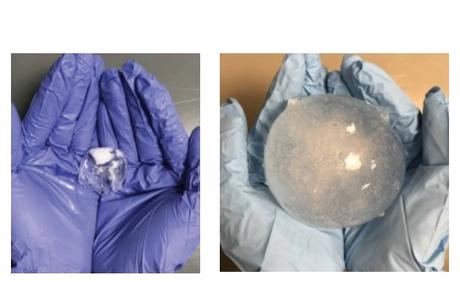 SANTÉ INTESTINALE : La pilule expansible qui surveille l'estomac durant un mois SANTÉ INTESTINALE : La pilule expansible qui surveille l'estomac durant un mois