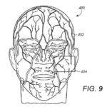 face ID veine du visage 150x150 - Brevet : et si Face ID sécurisait votre iPhone grâce aux veines de votre visage ?