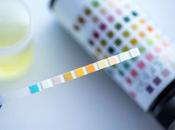 GREFFE d’ORGANE Détecter risque rejet l'urine plutôt biopsie