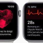 Apple Watch Series 4 Electrocardiogramme Francais 150x150 - Apple Watch : l’électrocardiogramme enfin disponible sur watchOS 5.2