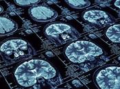 MALADIES NEURODÉGÉNÉRATIVES détecter évaluer grâce l’intelligence artificielle