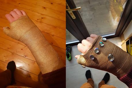Avec son poignet cassé, il transforme son plâtre en gant de Thanos