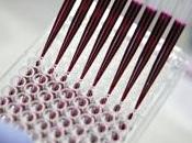 ONCOLOGIE dispositif portable biopsie liquide