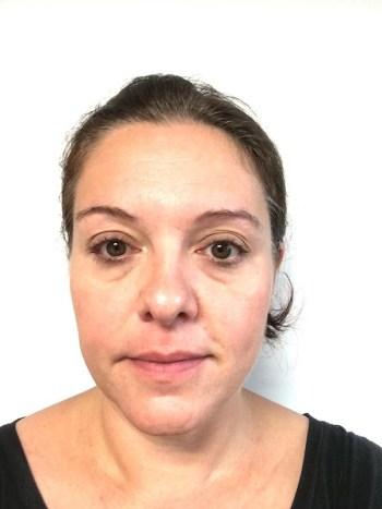 J’ai testé la cure Centella anti-rides fermeté