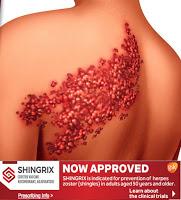 Un vaccin contre le zona difficile à ignorer !