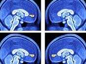 AUTISME approche diagnostique simple imagerie