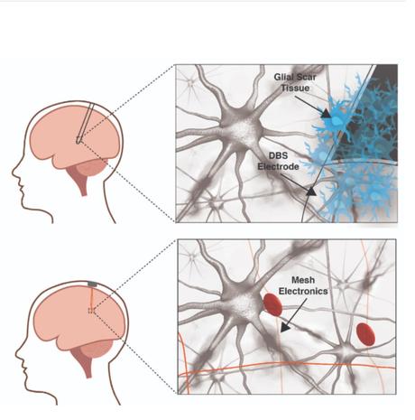 Avec le temps, ces nano-implants pourraient agir comme des substituts neuronaux, remplaçant des circuits endommagés pour rétablir les connexions et se recalibrer.