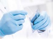 CANCER PROSTATE test sanguin précis qu'il évite biopsie