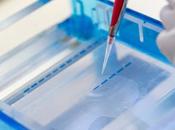 PLAIES CHRONIQUES topique base d’antihypertenseur