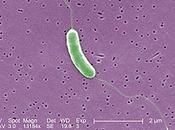 #trendsinmicrobiology #vibriovulfinicus Vibrio vulfinicus