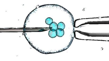 Bioéthique 2019 (1) : la PMA, le contraire de l’IVG ? Bioéthique 2019 (1) : la PMA, le contraire de l’IVG ?
