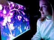 ÉPILEPSIE, syndrome d’Angelman L’intérêt cannabidiol nouveau confirmé
