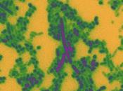 MICROBIOME INTESTINAL Comment bactéries livrent bataille sans merci