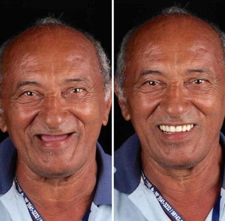 Felipe Rossi, le dentiste qui soigne gratuitement le sourire des plus démunis