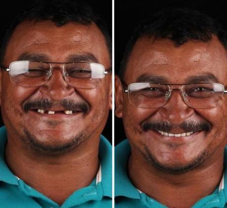 Felipe Rossi, le dentiste qui soigne gratuitement le sourire des plus démunis