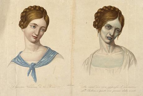 Pendants temporels : une transformation A young Venetian woman, aged 23, depicted before and after contracting cholera. Coloured stipple engraving. Courtesy of Wellcome Library, London