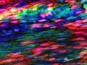 TENDINITE piste cellules souches tendineuses
