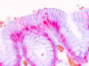 L’INTESTIN impliqué dans développement sclérose plaques