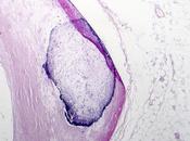 VIEILLISSEMENT L’âge est-il lui-même facteur maladie cardiovasculaire