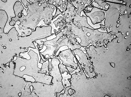 Les larmes à travers un microscope