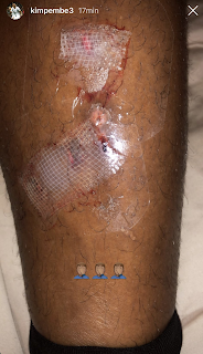 PSG Montpellier : un petit bisou à Delort et ses potes PSG Montpellier : un petit bisou à Delort et ses potes