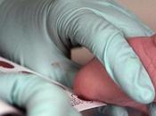 AUTISME Objectif, détecter naissance partir d’une goutte sang