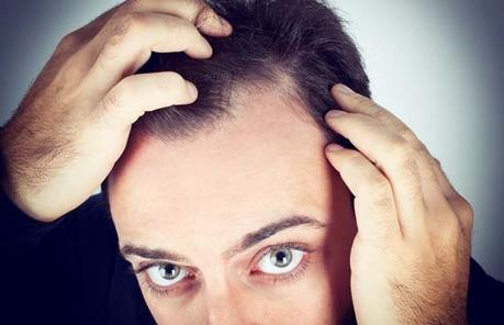 Quels types de compléments capillaires face à la perte de cheveux ?