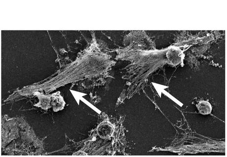 Les neutrophiles explosent et libèrent ces filets antimicrobiens composés de fibres d'ADN (Voir visuel noir et blanc), des enzymes bactéricides et des molécules pro-inflammatoires. 