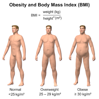 #EClinicalMedicine #exclusif #obésité #poidsdecharge Un poids de charge augmenté provoque une diminution du poids corporel et de la masse adipeuse chez des sujets obèses – Essai clinique randomisé preuve de concept
