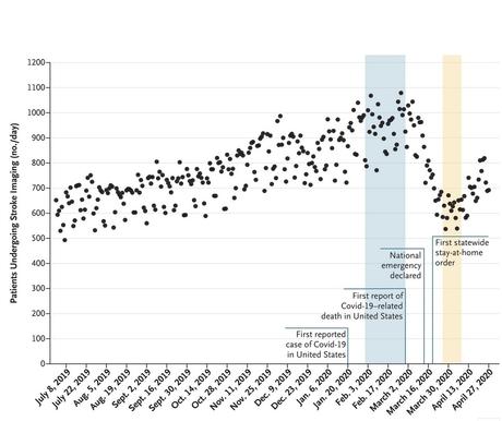 Pendant la pandémie, le nombre d'analyses cérébrales pour AVC a chuté de 39%