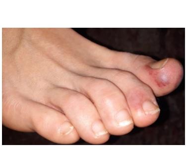 Visuel International Federation of Podiatrists Visuel International Federation of Podiatrists